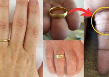 વીંટી પહેરતા લોકો થઈ જાવ સાવધાન ! જો આવું થશે તો કપાવવી પડશે તમારી આંગળી… વીંટી પહેરતા લોકો જાણો ચોંકાવનારી માહિતી…