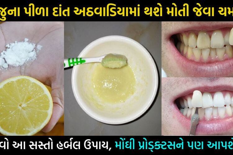 ગમે તેવા પીળા દાંત મફતમાં થશે સફેદ મોતી જેવા, અજમાવો આ હર્બલ ઉપાય… વધી જશે દાંતની સફેદી અને ચમક…