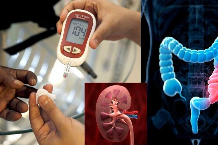 આટલું કરશો તો ક્યારેય નહિ વધે શુગર, જૂનામાં જૂની કબજિયાત તોડી વધારી દેશે કિડનીનું આયુષ્ય… જાણો આજીવન હેલ્દી રહેવાની બેસ્ટ ટીપ્સ…